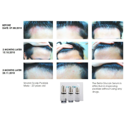 BETA super serum 1 stk