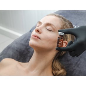 Microneedling hjemmebehandling til ansigtet