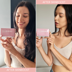 SkinBOOST &#150; kosttilskud til hud, hr, jenvipper og negle